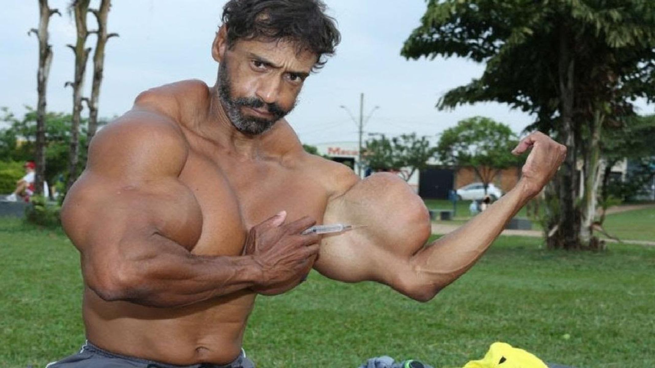 What Is Synthol, What Are Its Harms, What Is Synthol Good For, Is It Legal To Use Synthol?