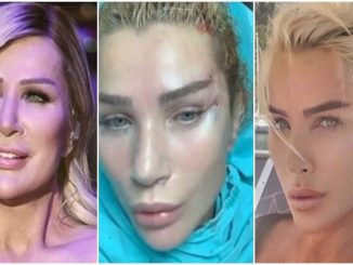 Estetikte Fransız Askısı Nedir? Nasıl Uygulanır? - RayHaber