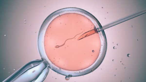 Kısırlık Tedavisinde Devrim: Yapay Zeka ile Sperm Bulma Teknolojisi - RayHaber